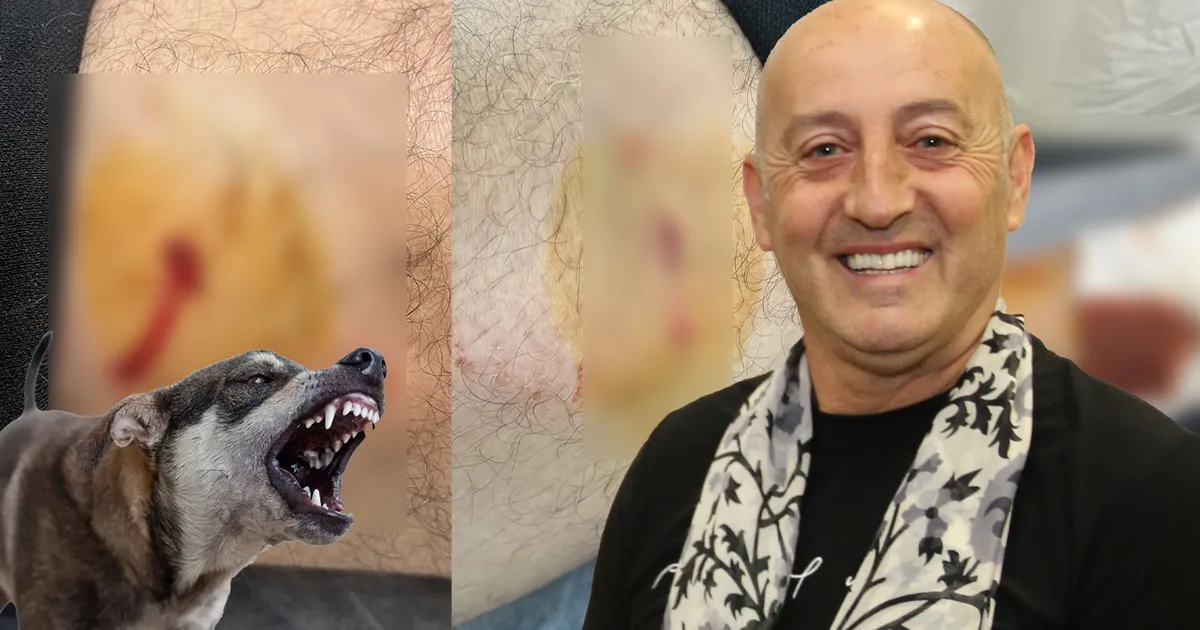 Gemlik Karacaali Muhtarı’na sokak köpeklerinden saldırı!